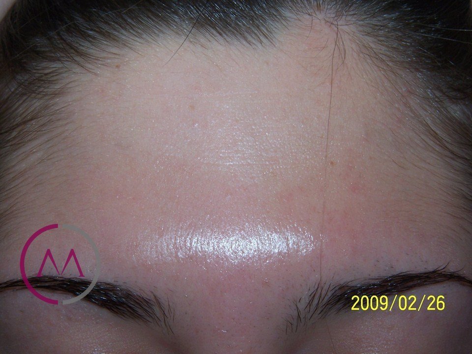 After image