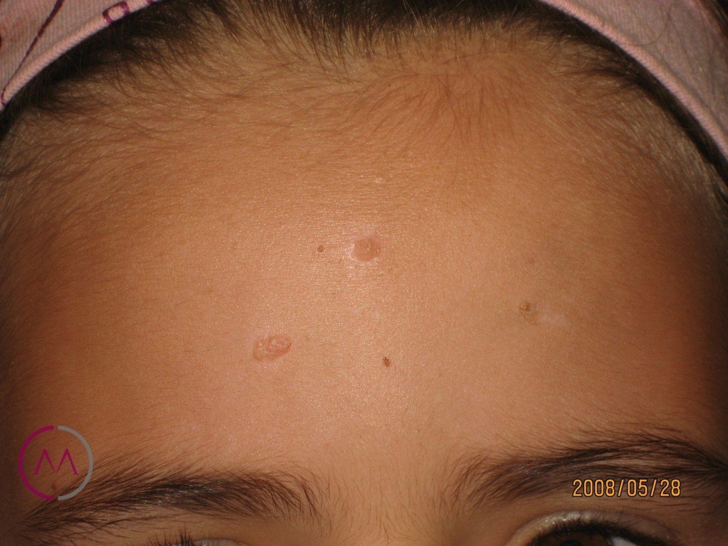 Before image