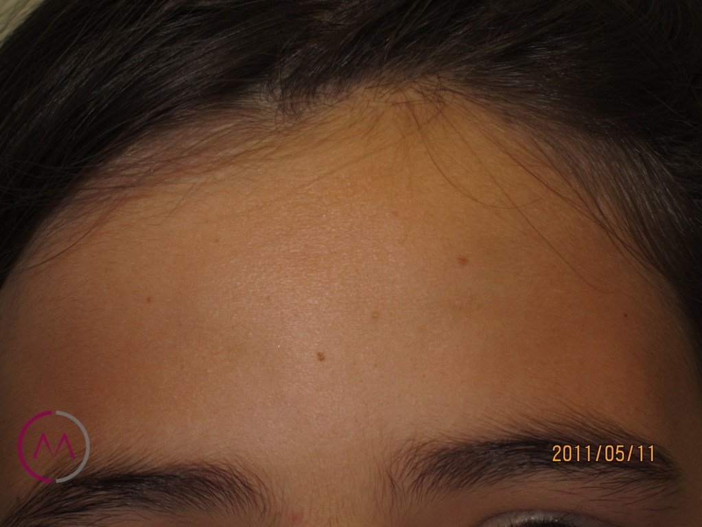 After image