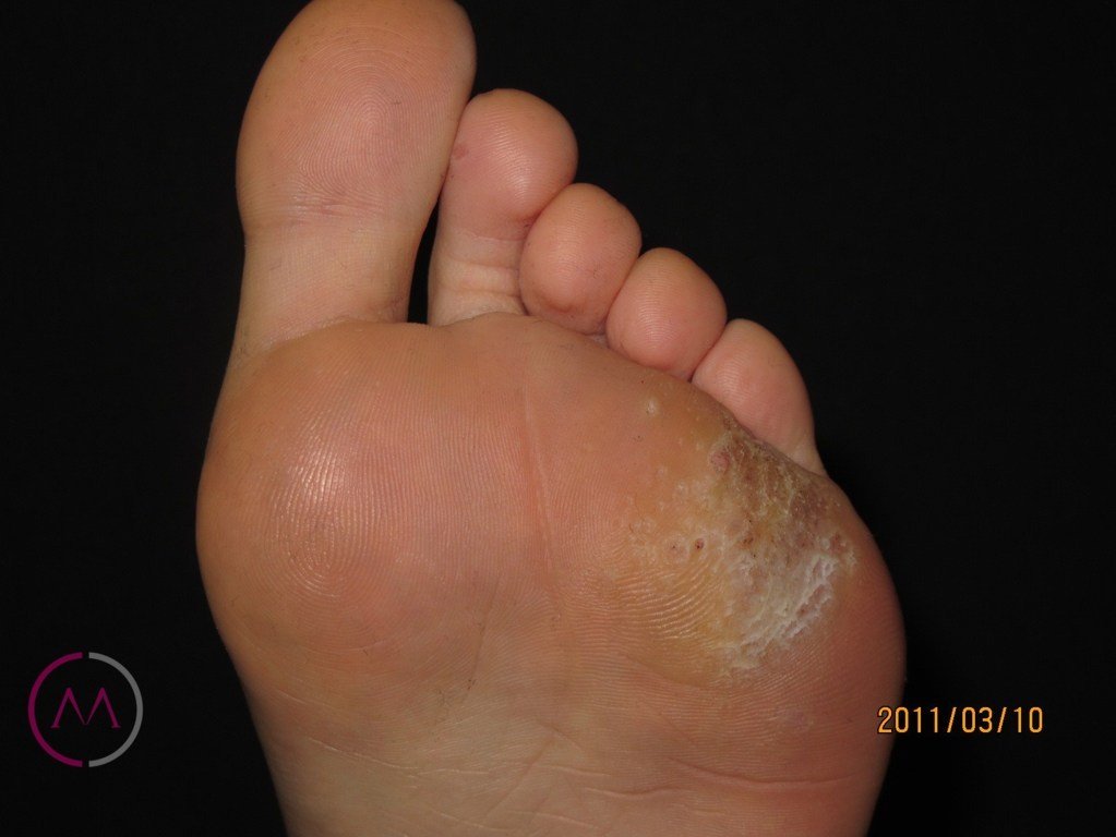 Before image