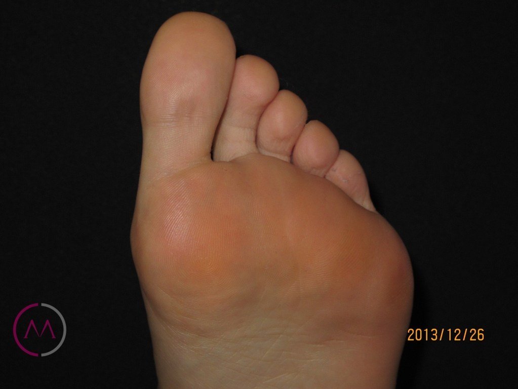 After image