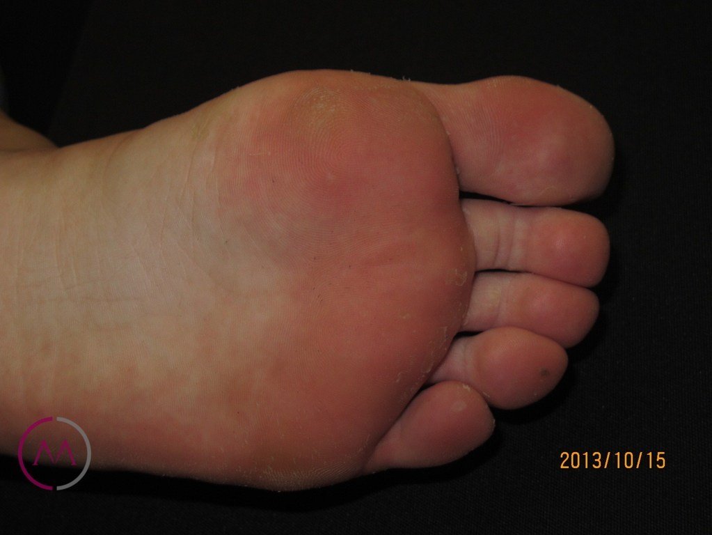 After image